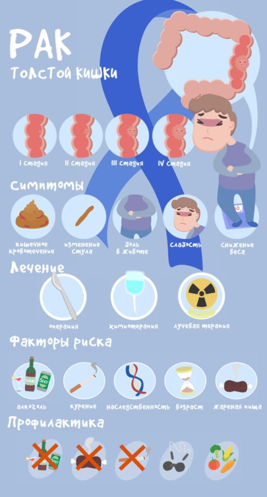 Рак толстой (ободочной) кишки - причины, распространенность, признаки, диагностика, симптомы
